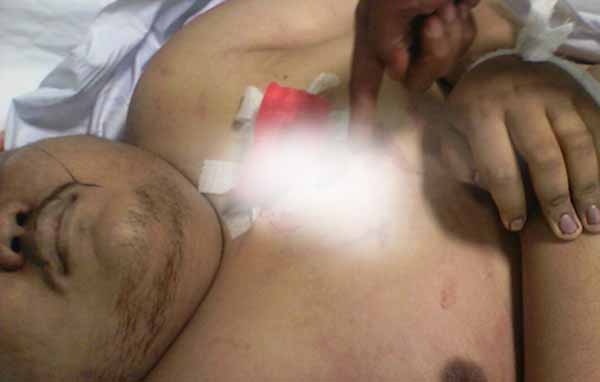 Usai Dugem, Anak Pengusaha Tewas Ditikam