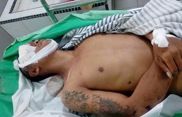 Hasil Copetan Rp20 Ribu, Pria Bertato Tewas