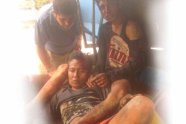 Maling Nyaris Tewas di Tembung