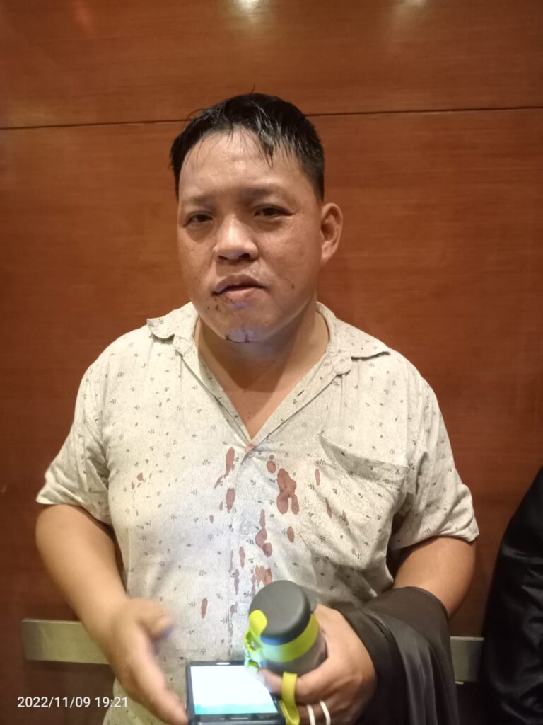 Tamu Hotel Grand City Dianiaya Hingga Berlumuran Darah