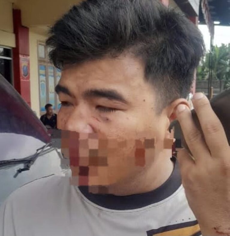 Pelaku Penganiayaan di Jalan Tangkahan Batu Patumbak Bebas Berkeliaran