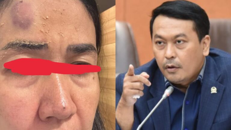 Anggota DPR RI Terseret Kasus Penganiayaan Mantan Istri, Badan Kehormatan Dewan Diminta Bertindak